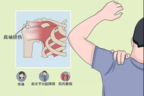 R-C，肩袖損傷